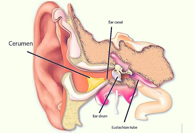 La cera del oído